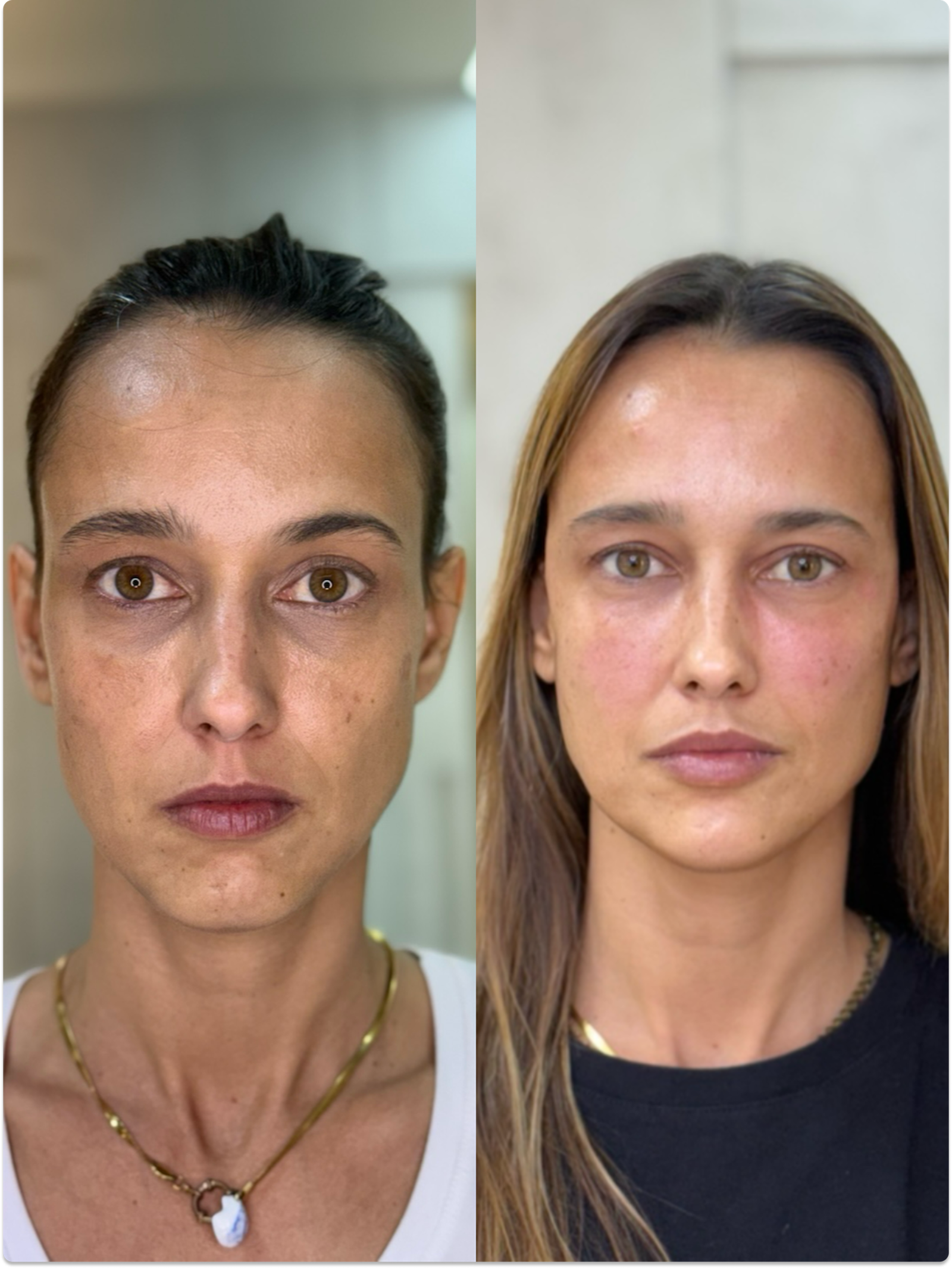 LV Face - enaltecer sem mudar a essência
